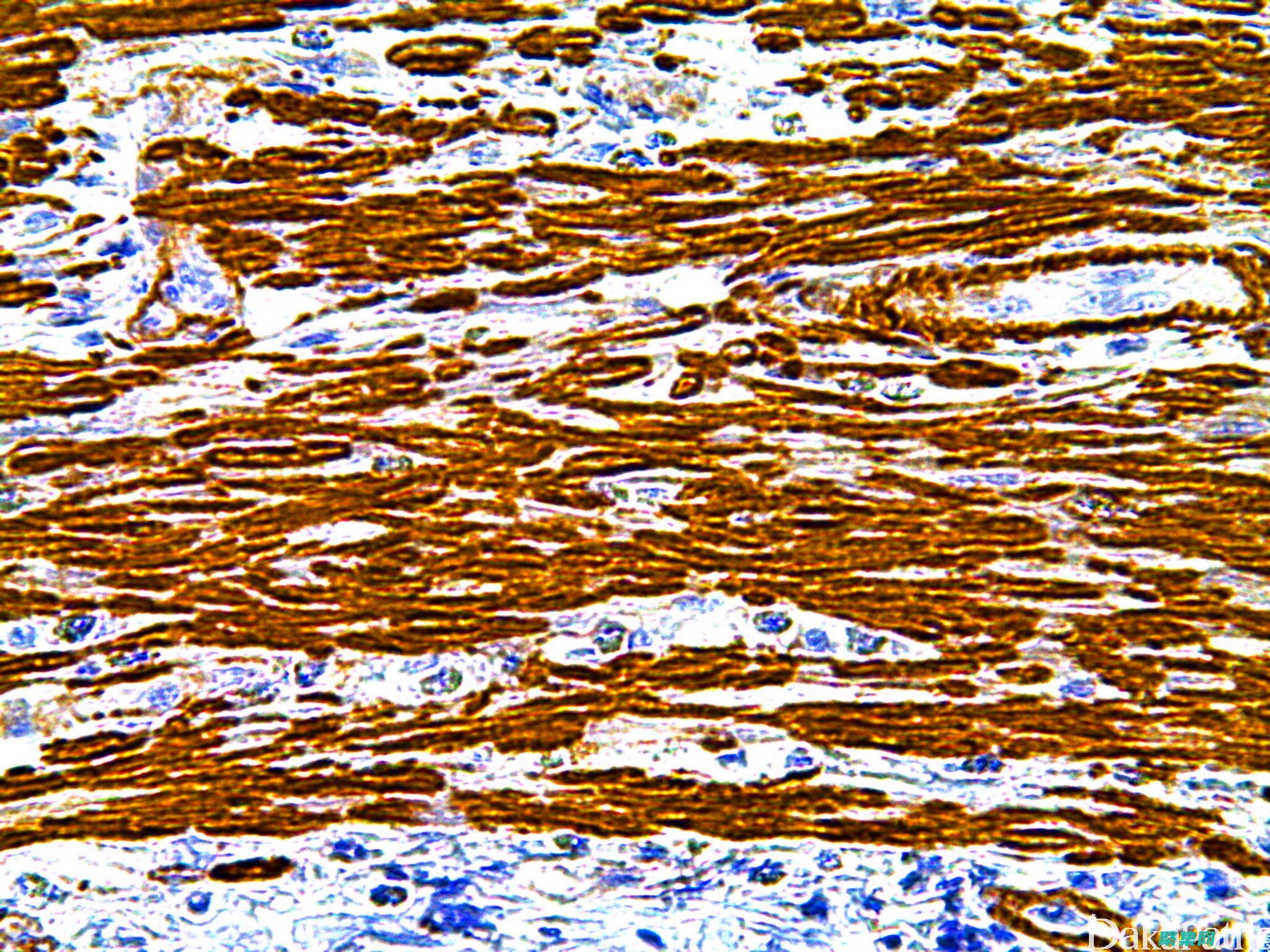 Smart制作本次活動的報名流程