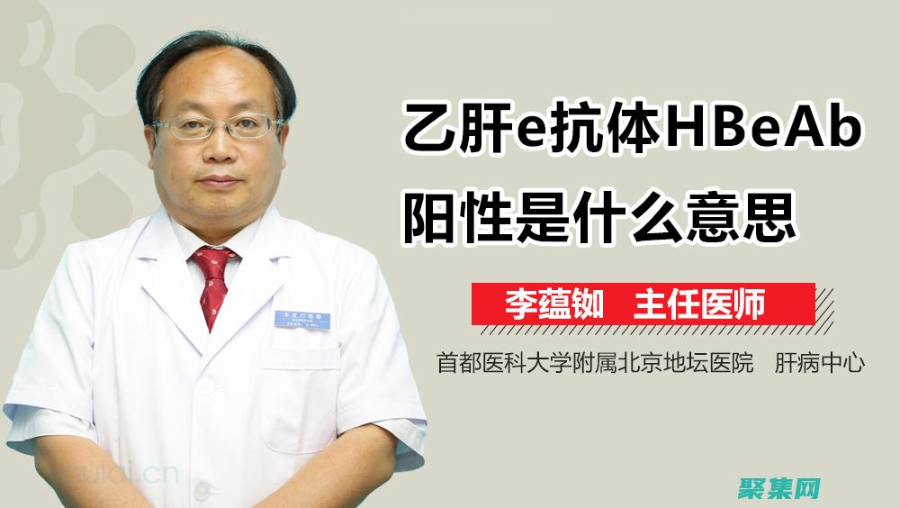 避免 Hibernate 二級緩存中常見陷阱和錯誤的最佳建議 (避免HIV)