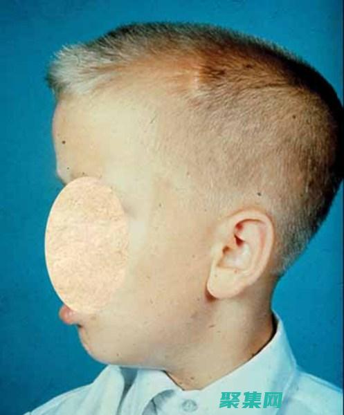 瀉下藥有哪些中藥